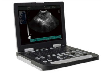 I-BN100 I-Laptop B ye-Ultrasonic Scanner ngenjongo yonyango lwezilwanyana 00 isishwankathelo